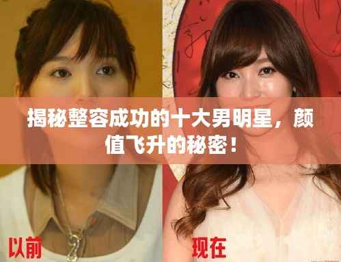 揭秘整容成功的十大男明星，颜值飞升的秘密！